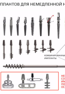 Виды имплантации зубов